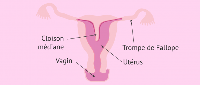 Imagen: uterus-cloisonne