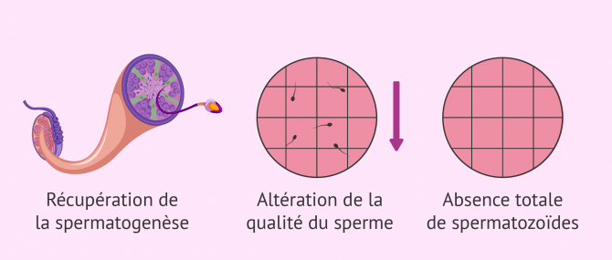 Imagen: Ne pas préserver sa fertilité