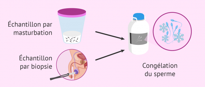 Imagen: origine échantillon de sperme