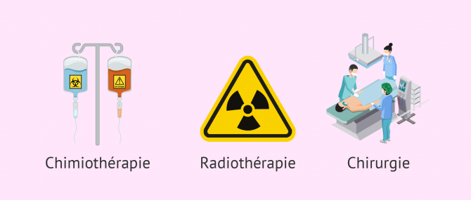 Imagen: therapies contre le cancer