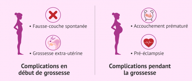 Imagen: risques d une grossesse avec endometriose