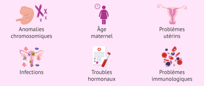 Imagen: Pourquoi des fausses couches surviennent-elles après une FIV?