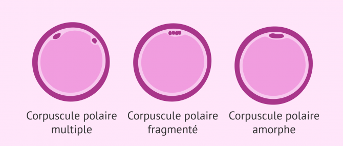 Imagen: Vérifier état réserve ovarienne