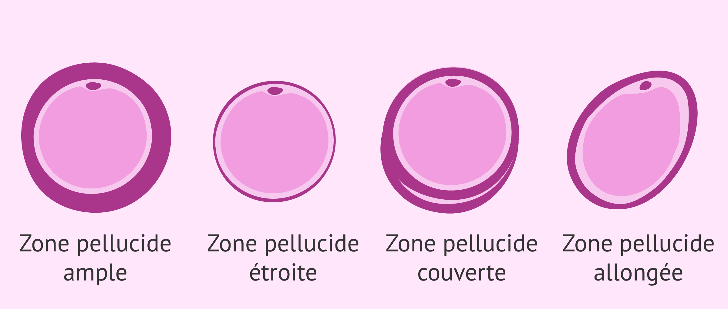 Alt rations De La Zone Pellucide Dans Les Ovocytes