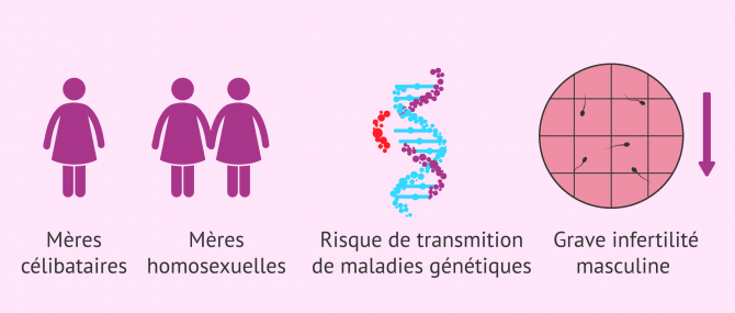 Imagen: Quand avoir recours à une insémination artificielle avec donneur