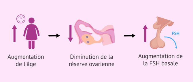 Imagen: Diminution de la réserve ovarienne et augmentation de la FSH