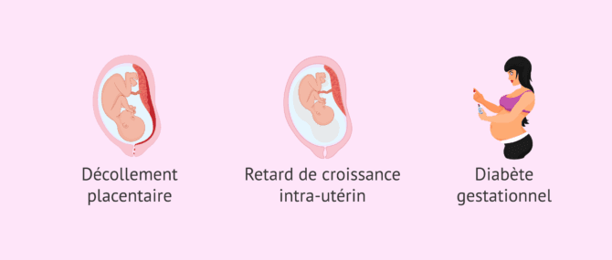 Imagen: Autres risques possibles d'être mère à plus de 40 ans