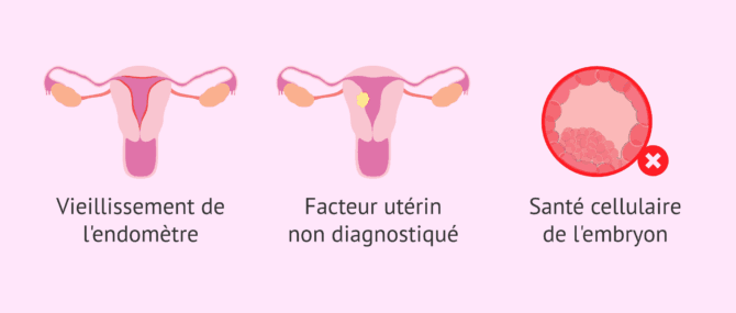 Imagen: Facteurs influençant le succès de la FIV avec PGT