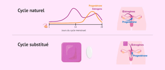 Imagen: Types de préparation endométriale pour le transfert d'embryons congelés