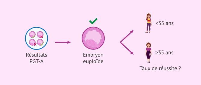 Imagen: L'âge affecte-t-il le succès du transfert d'embryons euploïdes?