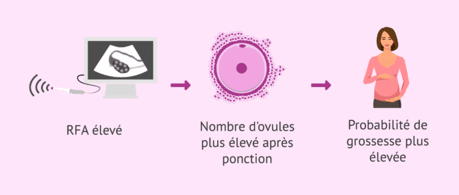 Imagen: Réserve ovarienne et résultats en procréation assistée