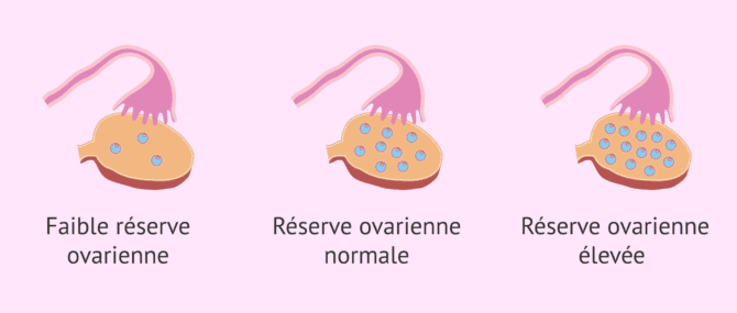 Imagen: Résultats après le compte des follicules antraux