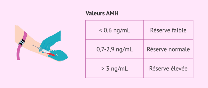 Imagen: Résultats de l'hormone anti-müllérienne