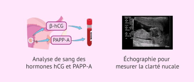 Imagen: Examens médicaux à la 9ème semaine de grossesse