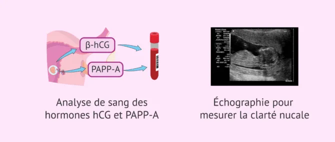 Imagen: Examens médicaux à la 9ème semaine de grossesse