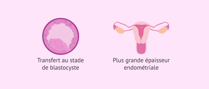 Imagen: Stratégies contre l'échec d'implantation