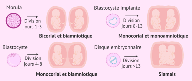 Imagen: Types de jumeaux monozygotes