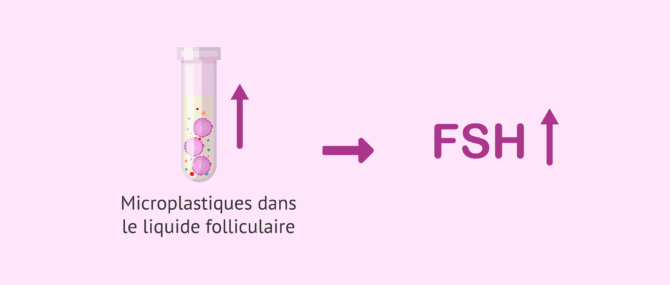 Imagen: Conséquences des microplastiques dans le liquide folliculaire