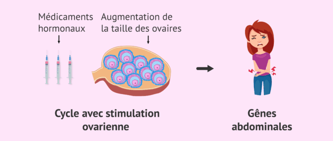 Imagen: Gênes liées à la stimulation ovarienne