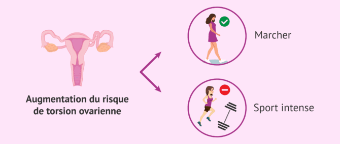 Imagen: Exercice physique pendant la stimulation ovarienne