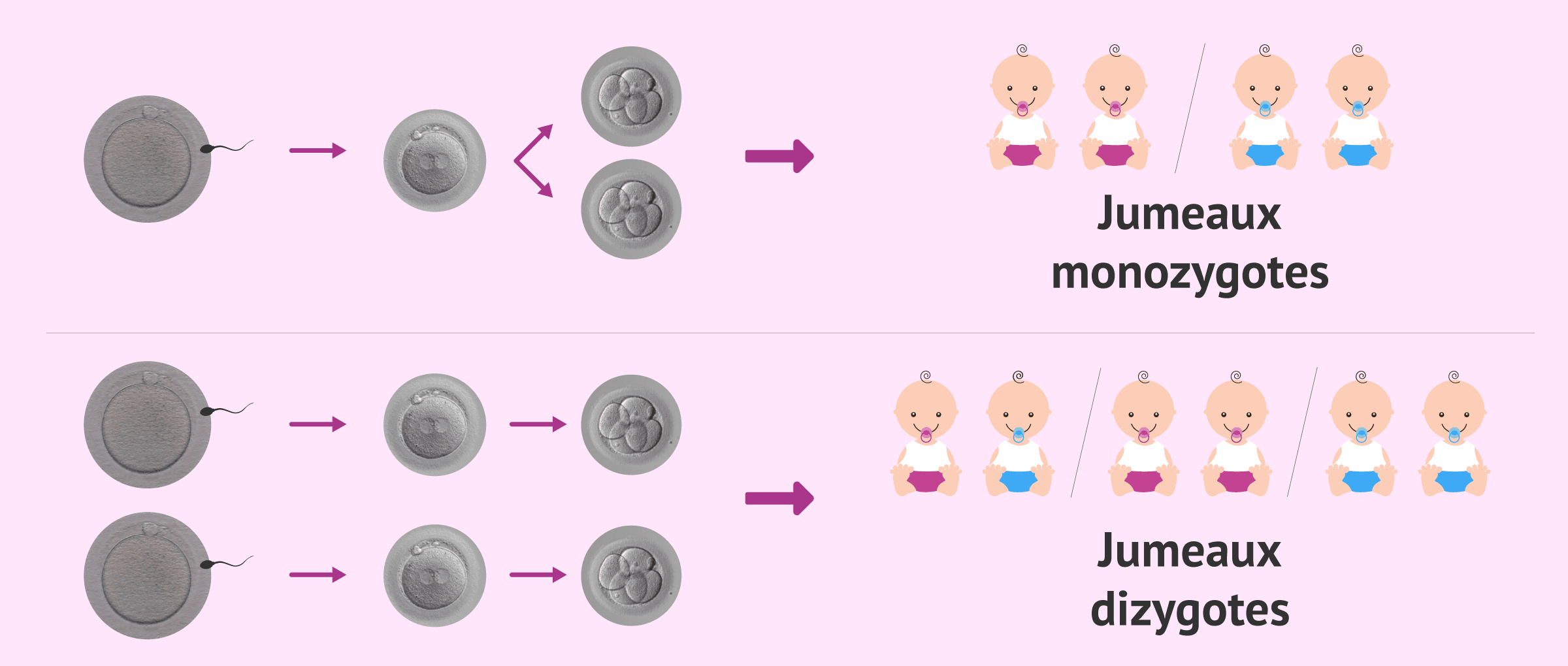 La grossesse multiple