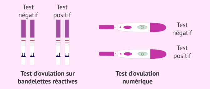 Imagen: Types de tests d'ovulation