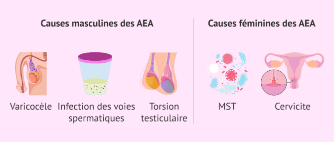 Imagen: Origine des anticorps anti-spermatozoïdes (AAS)