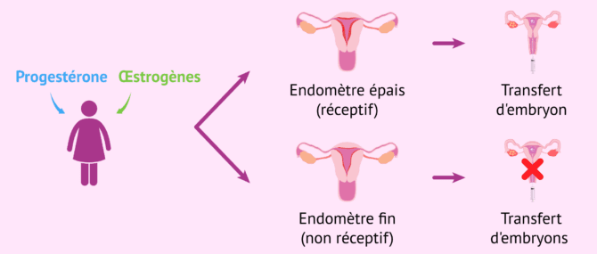 Imagen: Comment doit être l'endomètre pour le transfert ?