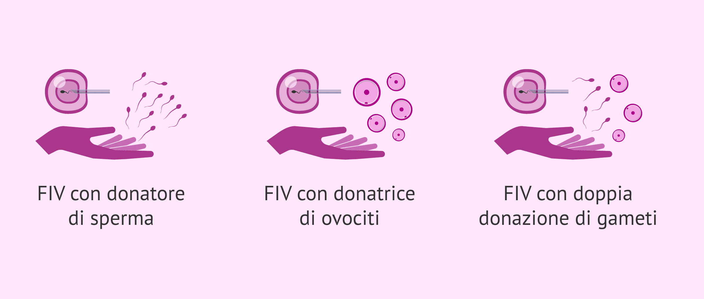 Imagen: Alternatives de la FIV avec changement de gamètes