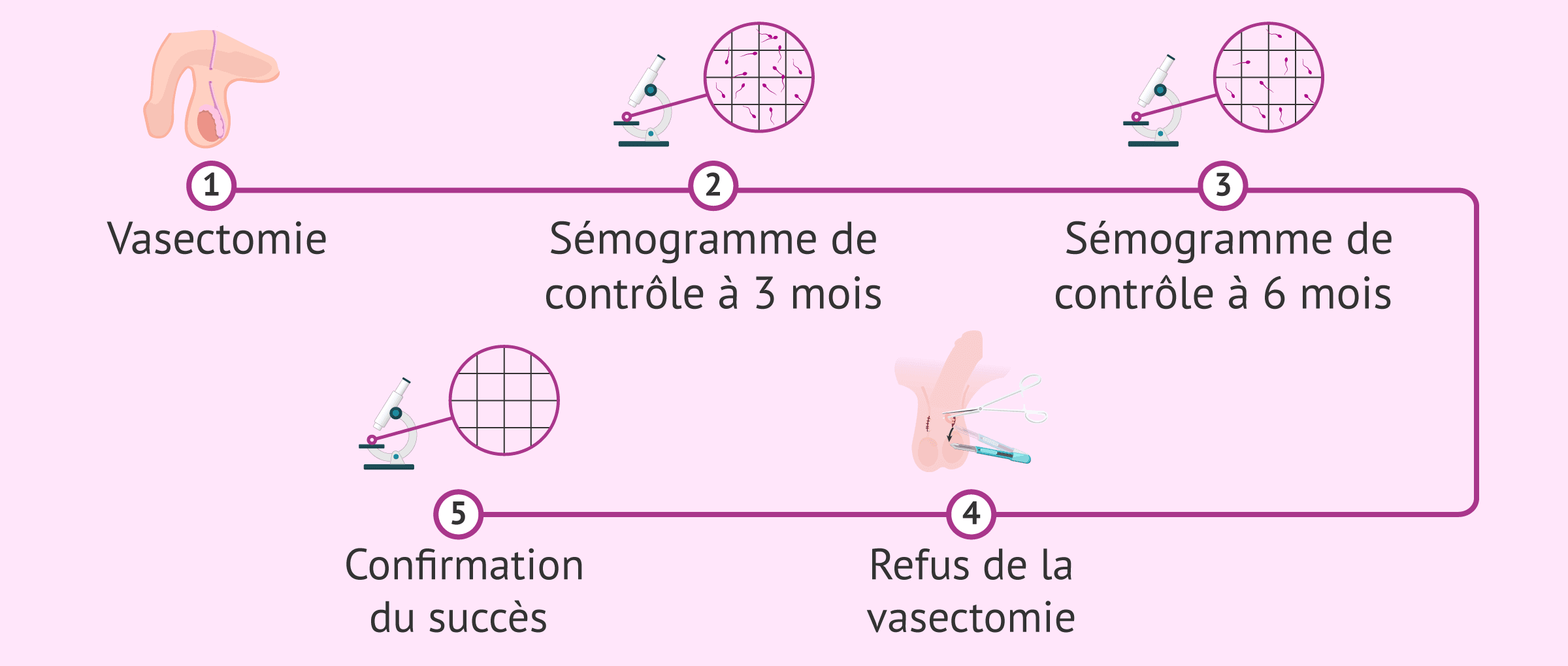 Imagen: Refaire la vasectomie en cas d'échec