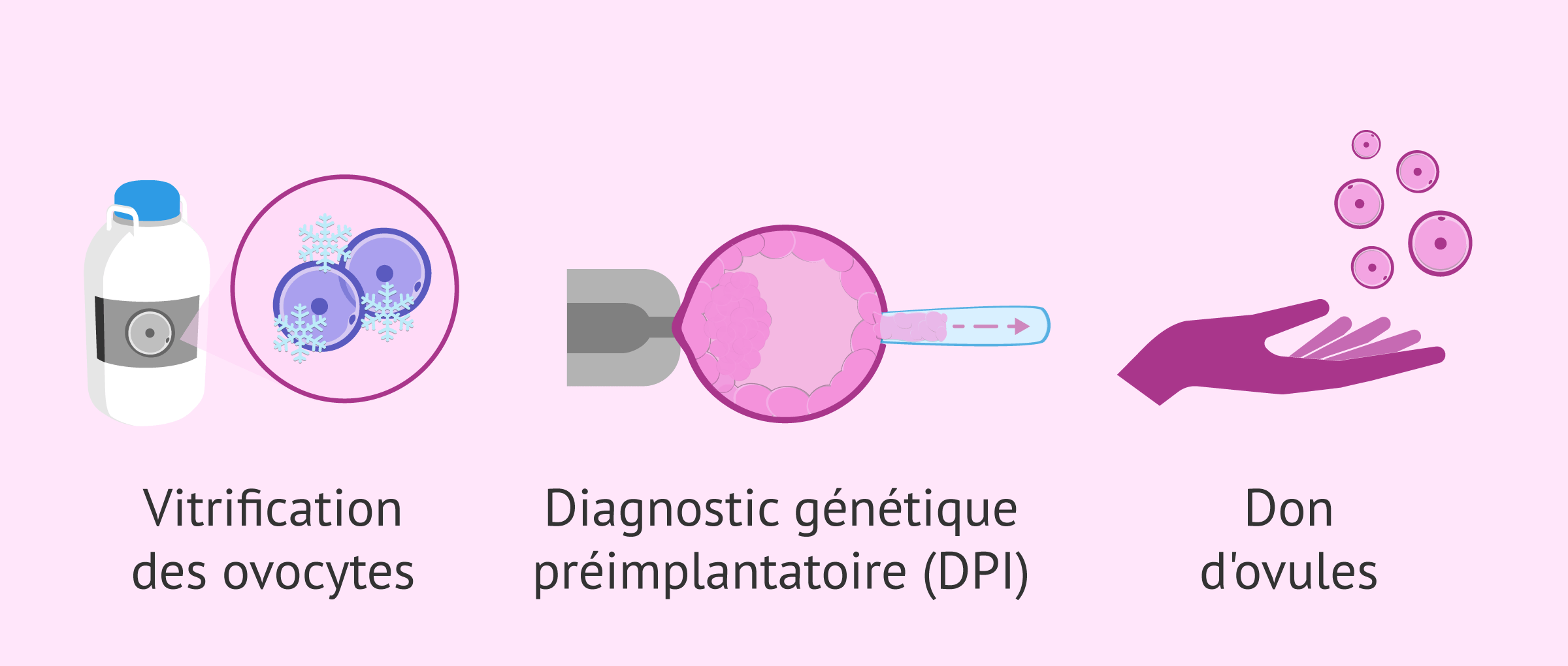 Imagen: Techniques de reproduction assistée pour les femmes de 40 ans