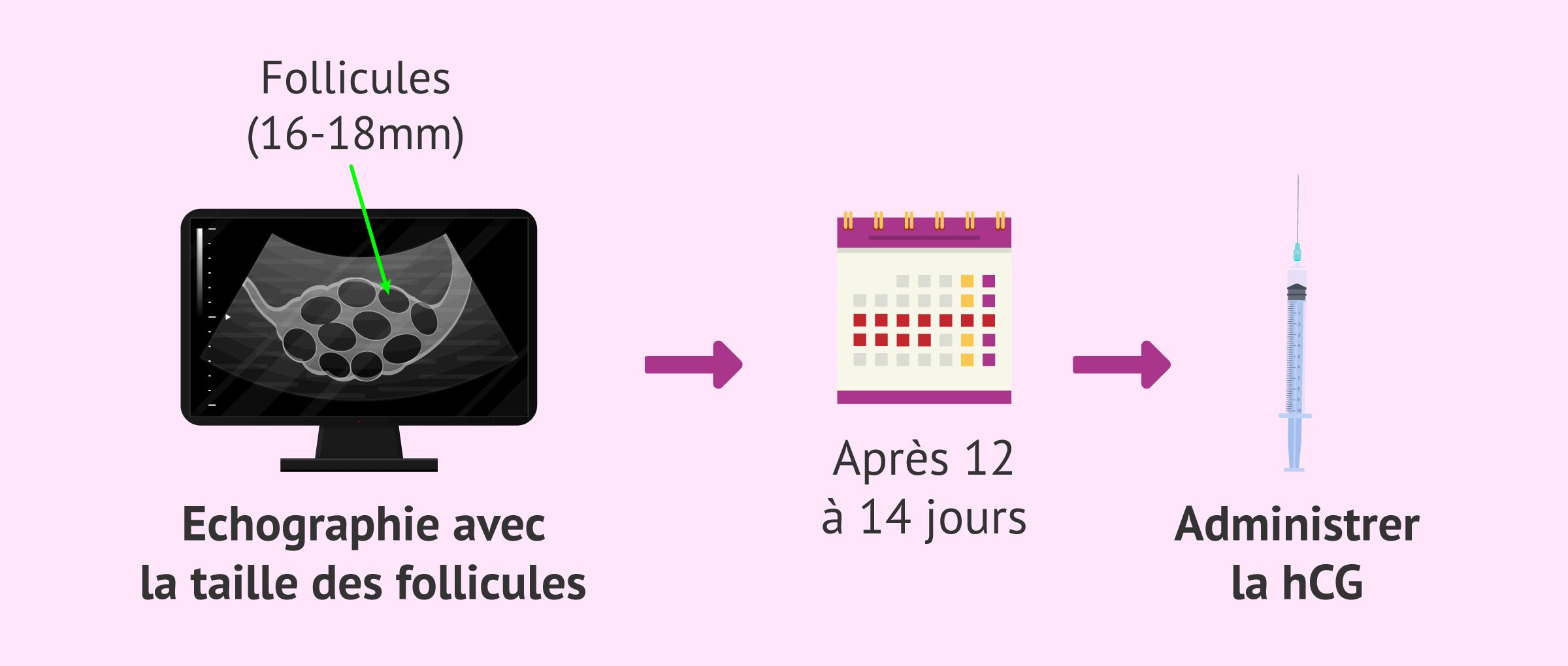 Imagen: Contrôle échographique et administration de la hCG