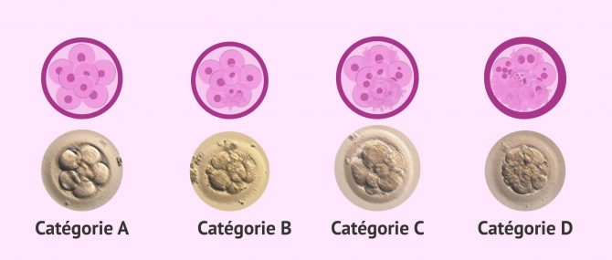 Imagen: Classification en fonction de la qualité embryonnaire