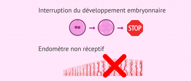 Imagen: Raisons de la suspension du transfert d'embryons