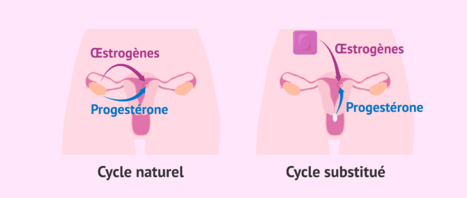 Imagen: Transfert d'embryons en cycle naturel ou substitué
