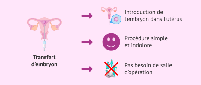 Imagen: Caractéristiques du transfert d'embryons