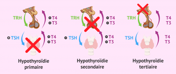 Hypothyro die Comment Affecte t elle La Fertilit Et La Grossesse