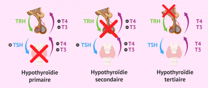 En Finir Avec L Hypothyroïdie Pdf Gratuit
