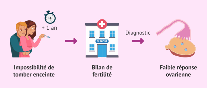 Imagen: Durée de l'infertilité et faible réserve ovarienne