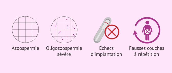 Imagen: Quand faut-il réaliser un caryotype?