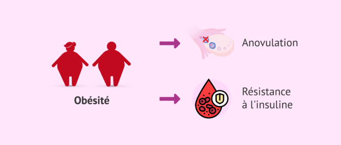 Imagen: Conséquences du surpoids sur la fertilité