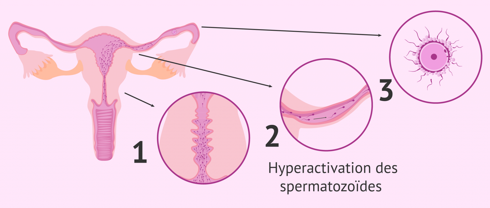 Trajet Des Spermatozoïdes Dans L'organisme Féminin