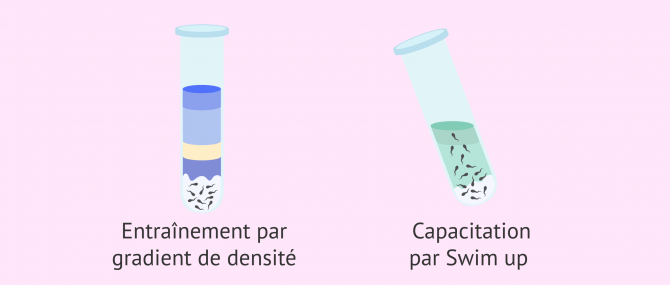 Imagen: Techniques de capacitation des spermatozoïdes