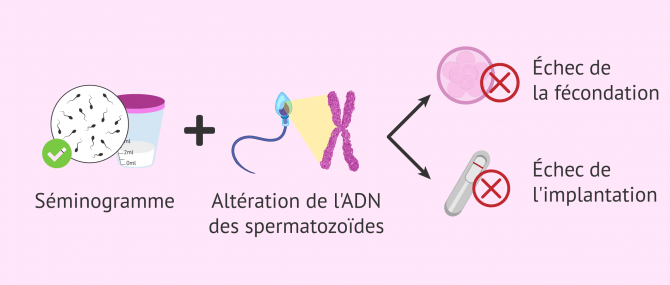 Imagen: Pourquoi une grossesse naturelle ne se produit-elle pas en cas de normozoospermie?
