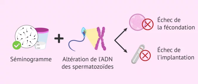 Imagen: Pourquoi une grossesse naturelle ne se produit-elle pas en cas de normozoospermie?