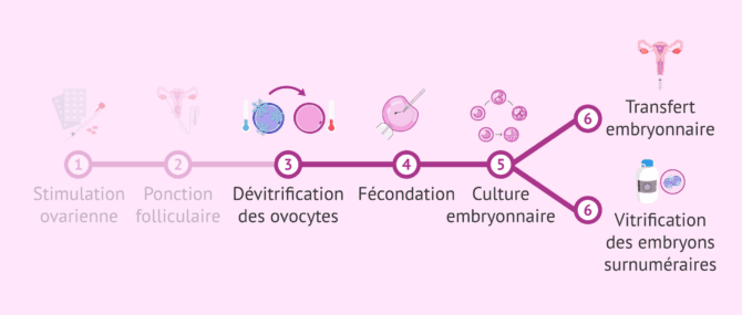 Imagen: Étapes de la FIV avec des ovules vitrifiés