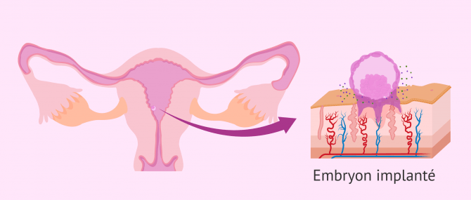 Imagen: Comment se déroule l'implantation d'un embryon?