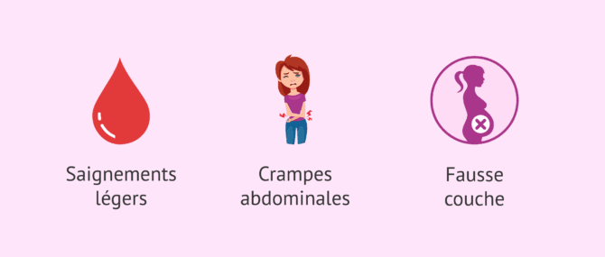 Imagen: Quels sont les risques liés au scratching endométrial?