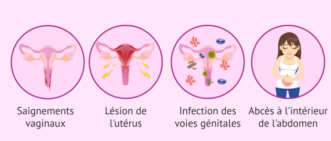 Imagen: Effets et risques possibles de l'avortement