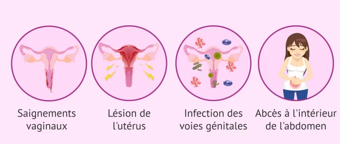 Imagen: Effets et risques possibles de l'avortement